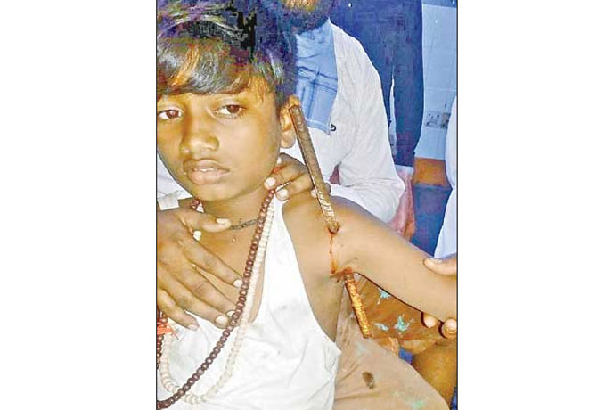 Iron rod stuck in boy body in Adilabad