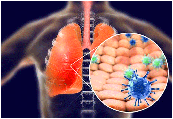Patients over age of 40 are at higher risk for covid infection