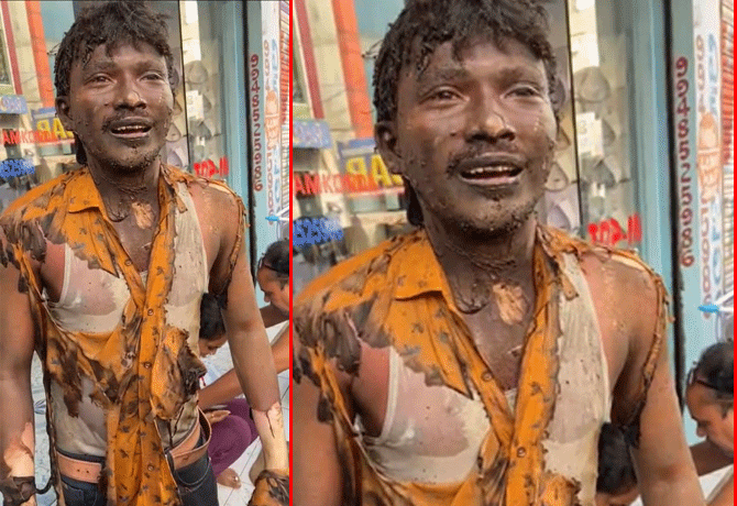 Woman-husband set man ablaze in Hanamkonda