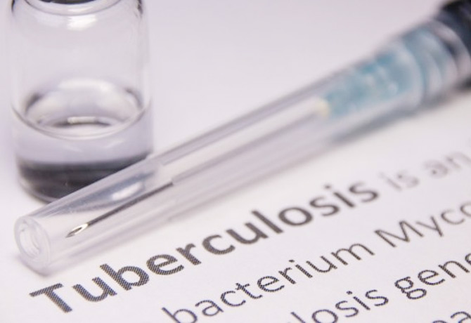 Tuberculosis in 155 persons who recovered from COVID-19