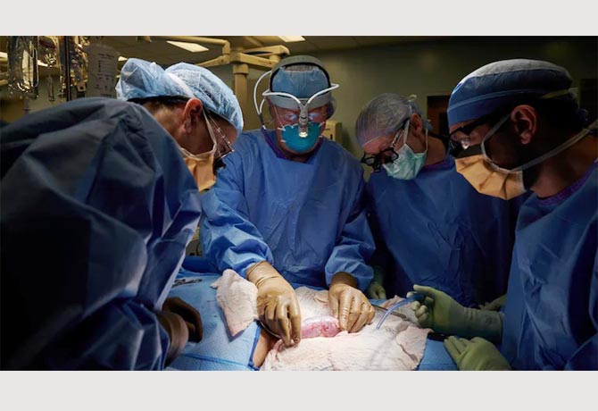 Surgeons attached Pig Kidney to human
