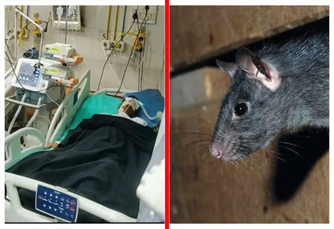Rats Bite Patient Leg and Hand Fingers in MGM ICU