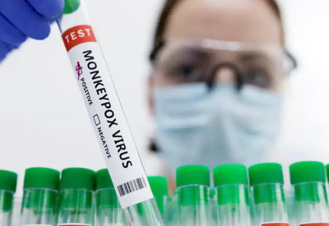 Trivitron develops test kit to detect Monkeypox