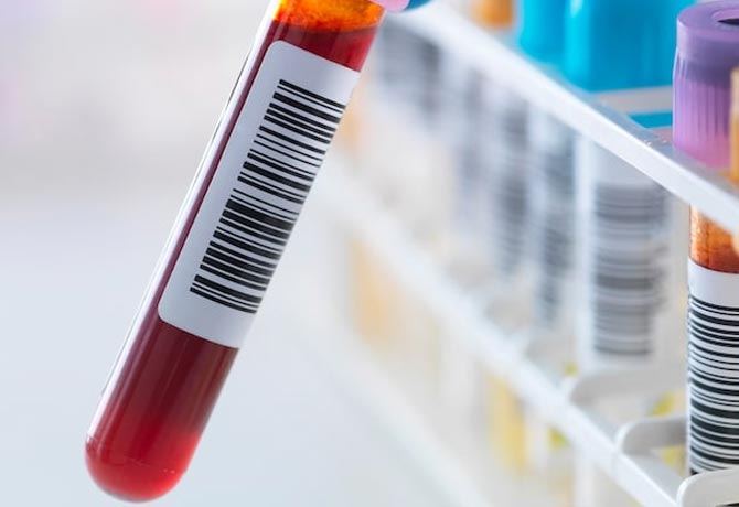 New blood test detects multiple cancers