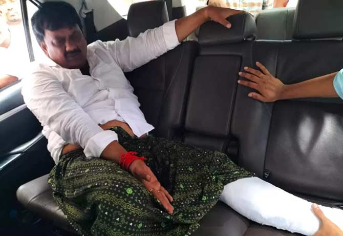 YSRCP MLA Uma shankar falls from bike