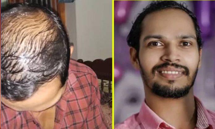Youth ends life over hair loss in kerala