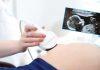 Free Tiffa screening tests for pregnant women