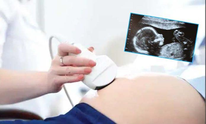 Free Tiffa screening tests for pregnant women