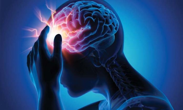 brain stroke symptoms