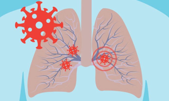 Lung problem caused by Corona