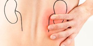 sunburn effect on kidneys
