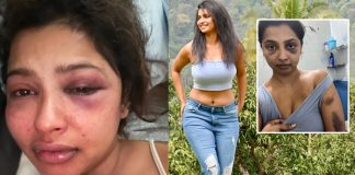 Anicka Vikhraman attack by boy friend