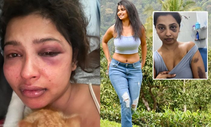 Anicka Vikhraman attack by boy friend