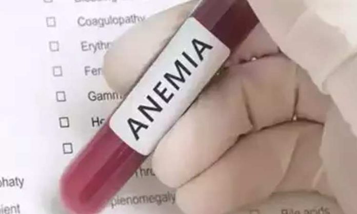 Anemia