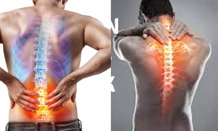 back-pain