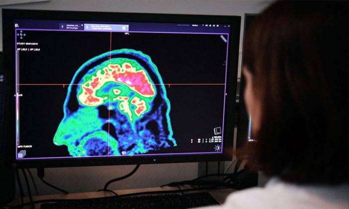 New AI tool can help treat brain tumors