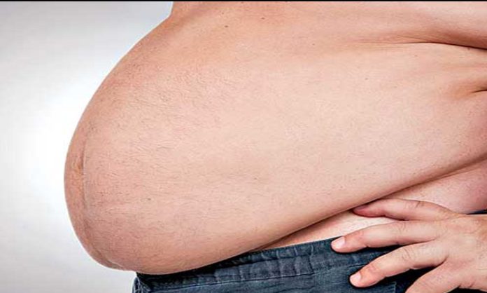 Obesity disease information