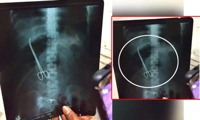Scissors Left Inside Patient at Eluru Hospital