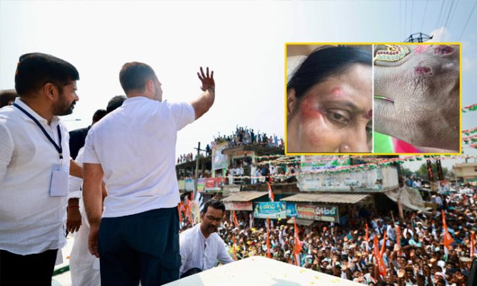 Konda Surekha injured in Rahul Gandhi's bike rally