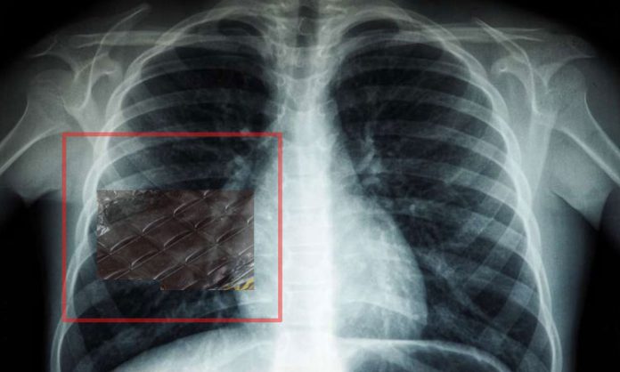 Chocolate rapper found in lungs