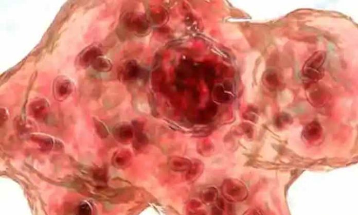 Braineatin Amoeba