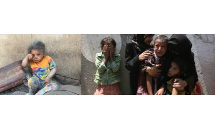 United Nations not implemented childrens rights