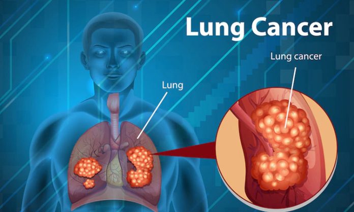 Lung cancer symptoms telugu