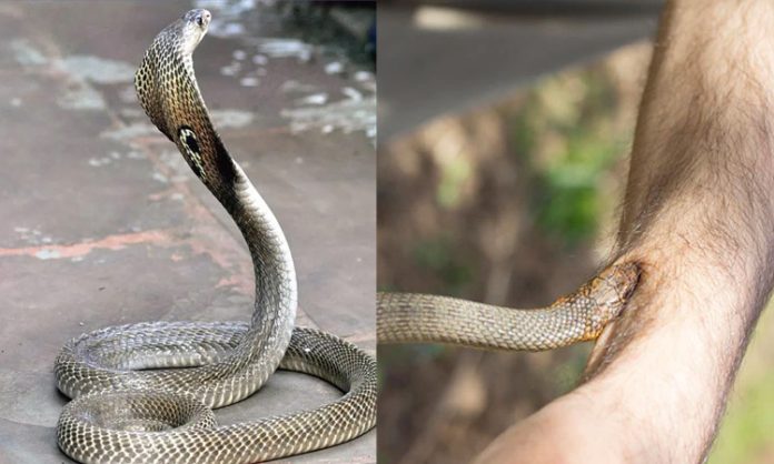 Treatment late for snakebite