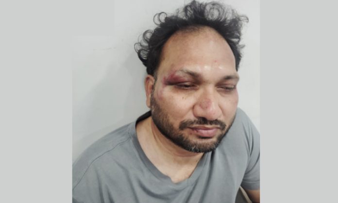 BJP workers attack on You tuber