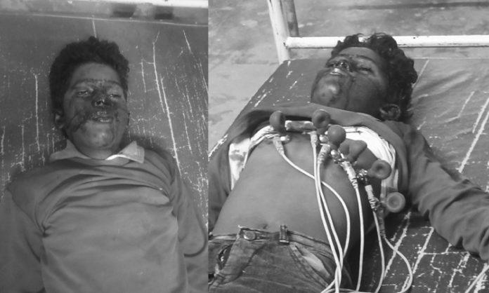 Amarachinta Mandal Wanaparthy