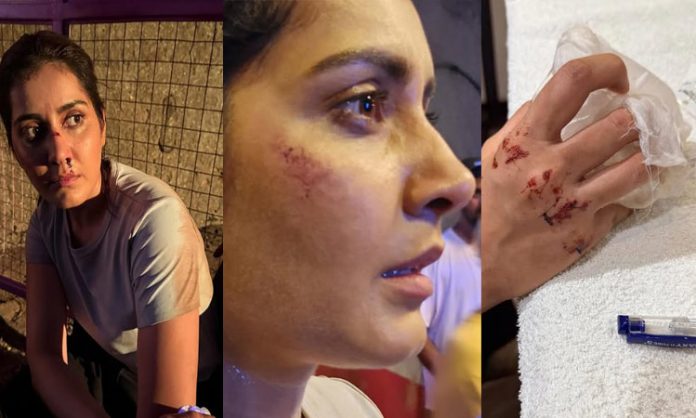 Raashi khanna injured