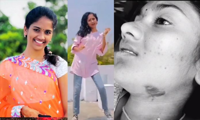 Youtuber madhumati dead in NTR dist
