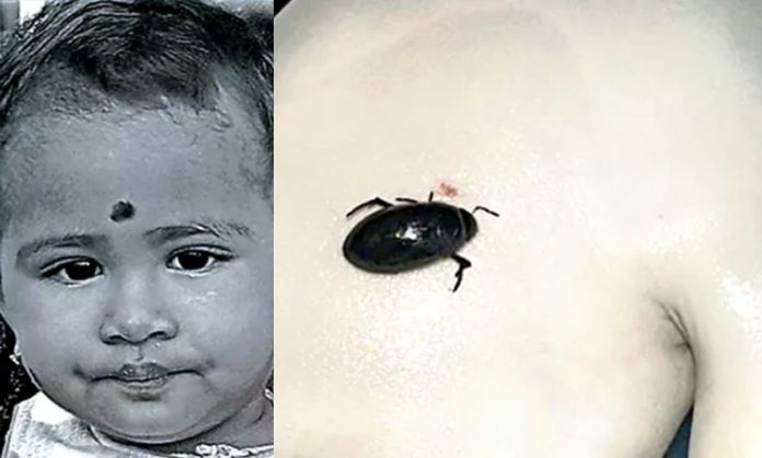 Girl swallowed Insect