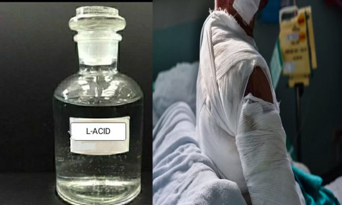 Wife acid attack on Husband